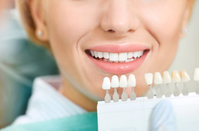 teeth whitening  in Amherst, NH